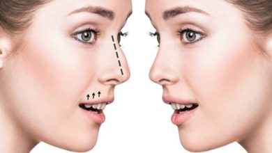 جراحی بینی-سایت خبری ازدیدما