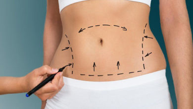 جراحی شکم-سایت خبری ازدیدما