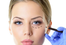 جراحی پلک-سایت خبری ازدیدما