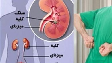 علامت های وجود سنگ کلیه -سایت خبری ازدیدما