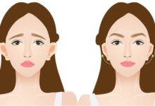 جراحی اتوپلاستی -سایت خبری ازدیدما