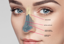 جراحی بینی -سایت خبری ازدیدما