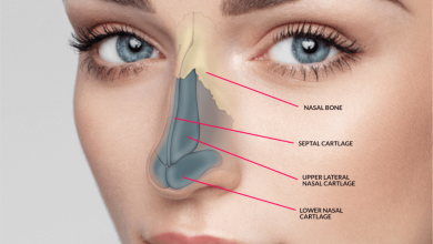 جراحی بینی -سایت خبری ازدیدما