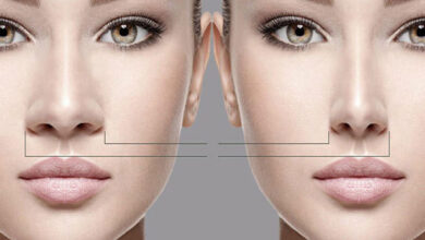 تفاوت بینی گوشتی و استخوانی