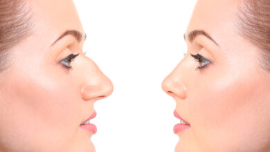 تفاوت جراحی بینی استخوانی و گوشتی -سایت خبری ازدیدما