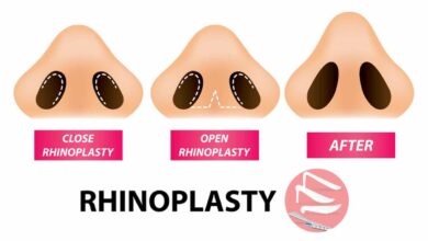 تفاوت جراحی بینی به روش باز و بسته -سایت خبری ازدیدما