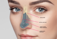 جراحی زیبایی بینی - سایت خبری ازدیدما