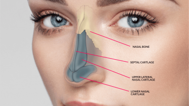 جراحی زیبایی بینی - سایت خبری ازدیدما