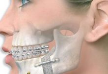 جراحی ژینوپلاستی - سایت خبری ازدیدما